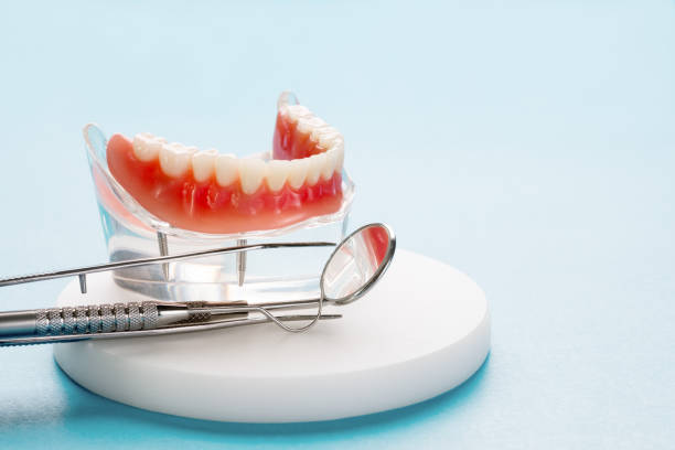 Dental Inlays and Onlays in South Monrovia Island, CA